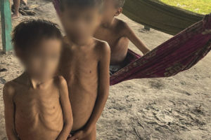 营养不良的儿童在亚村庄。