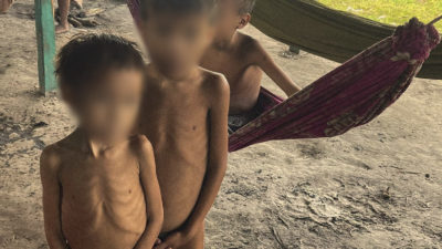在Yanomami村庄营养不良的孩子。