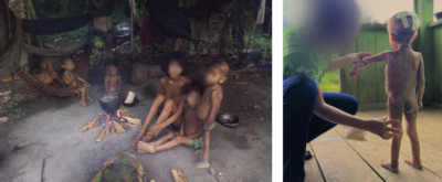 这些照片是最近几个月由土著人民和卫生工作者在Yanomami领土拍摄的。